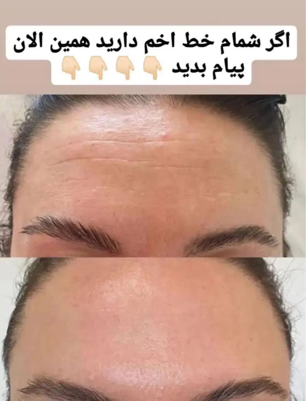 سرم لیفتینگ گاتیو|آرایشی، بهداشتی، درمانی|شیراز, طلاب|دیوار