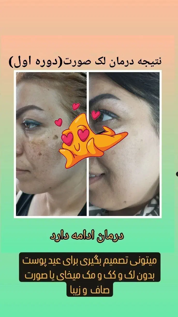 رشد مجدد موها فقط با محصولات طبیعی|آرایشی، بهداشتی، درمانی|فرمهین, |دیوار