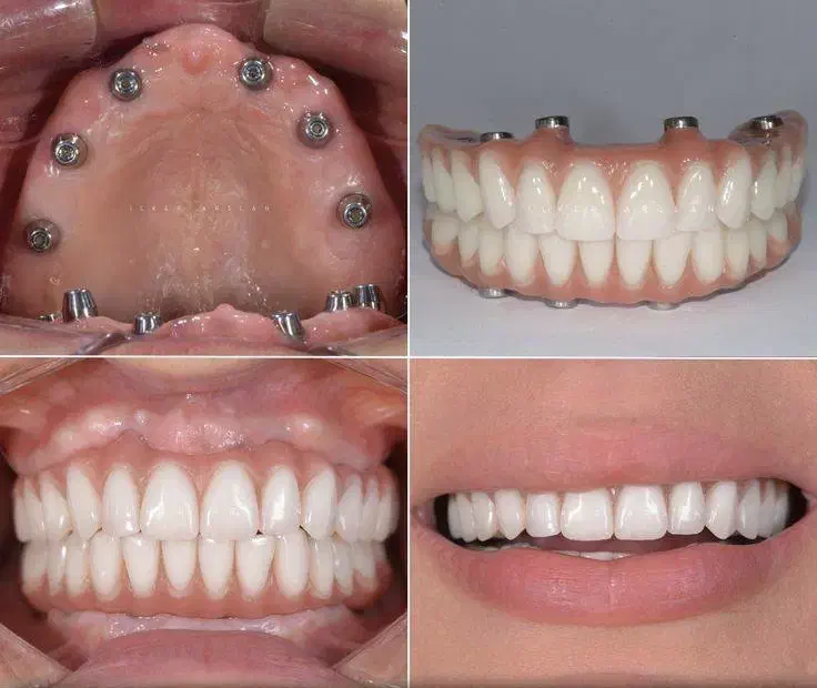 اوردنچر دوفک فقط ۱۰۰ تومن در تبریز|خدمات آرایشگری و زیبایی|مشگین شهر, |دیوار