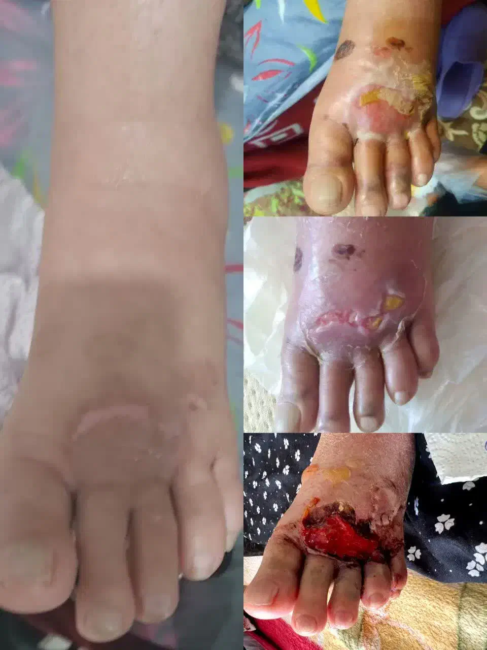 کلینیک تخصصی درمان زخم ( بستر و دیابت) فردوس|خدمات آرایشگری و زیبایی|اصفهان, بهار آزادی|دیوار