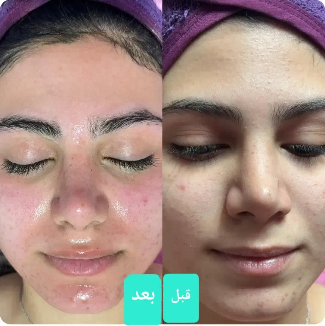 مژده مژده به عروس خانمها گل فیشیال عروس فقط 350|خدمات آرایشگری و زیبایی|اصفهان, خانه اصفهان|دیوار