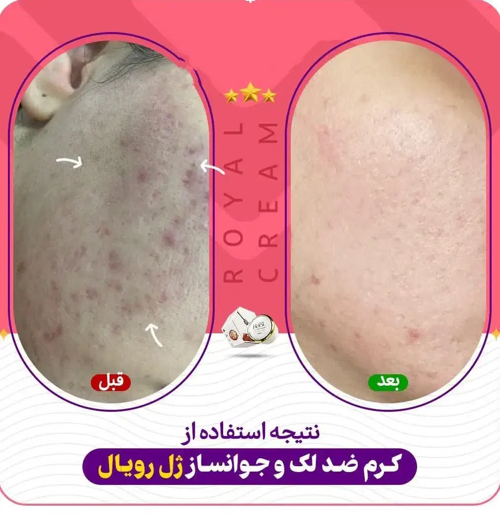 کرم ژل رویال صد در صد تضمینی|آرایشی، بهداشتی، درمانی|شیراز, حافظیه|دیوار