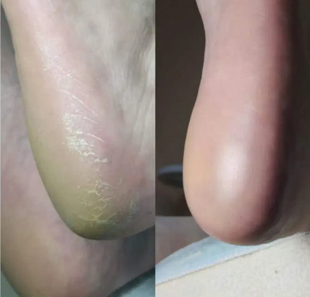 مدل کفسابی پا|خدمات آرایشگری و زیبایی|محمدیه-قزوین, |دیوار