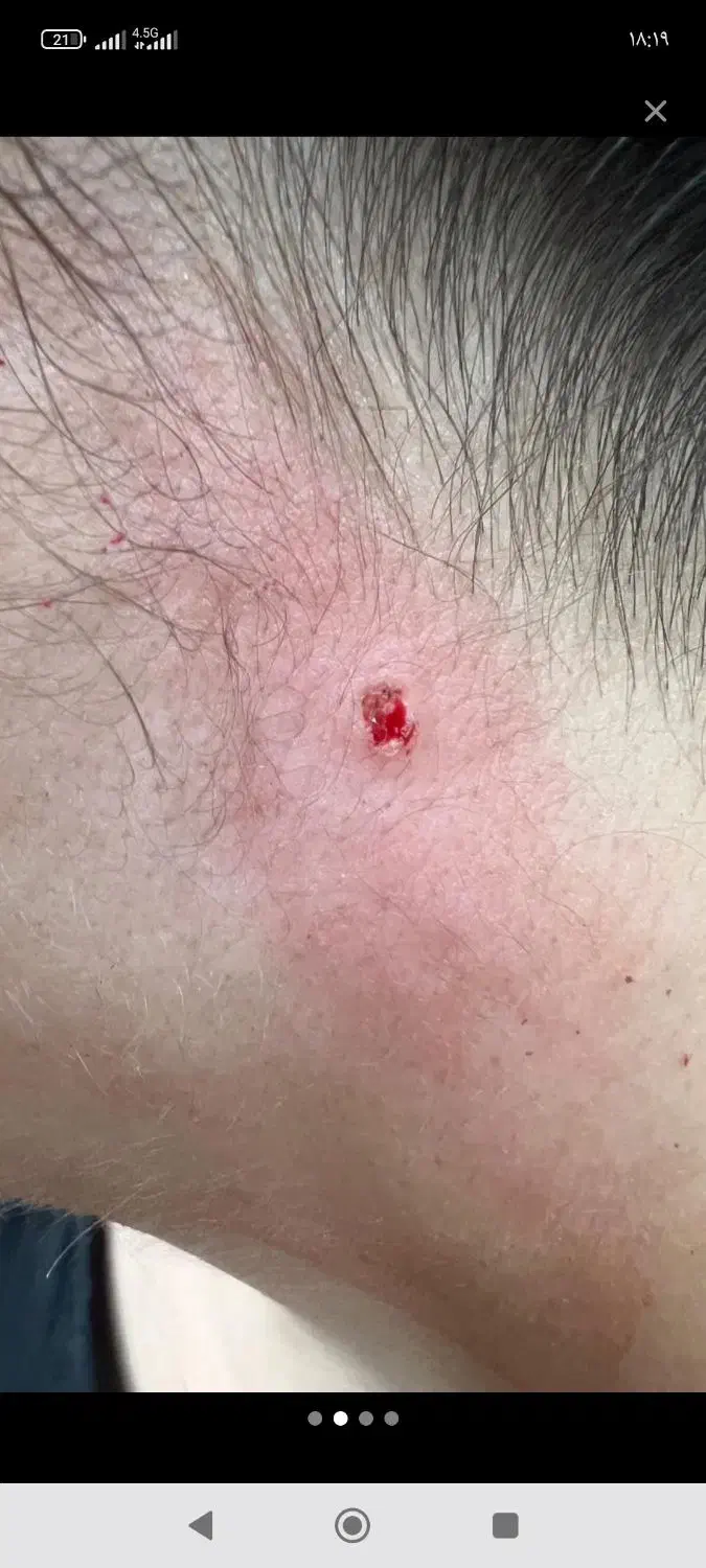 خال برداری|خدمات آرایشگری و زیبایی|قم, امامزاده ابراهیم|دیوار