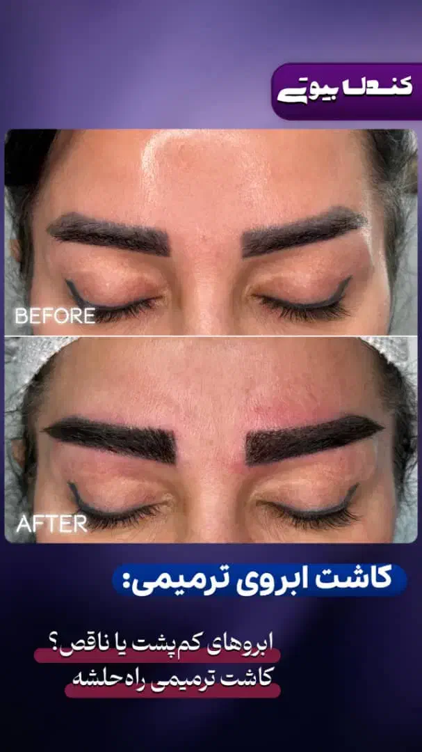 کاشت ابرو|خدمات آرایشگری و زیبایی|اندیشه, اندیشه فاز ۱|دیوار