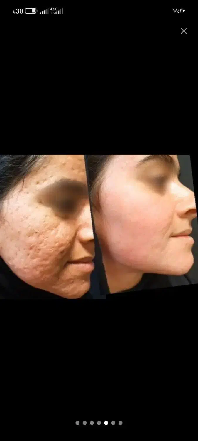 بینظیر|آرایشی، بهداشتی، درمانی|خرم‌آباد, |دیوار