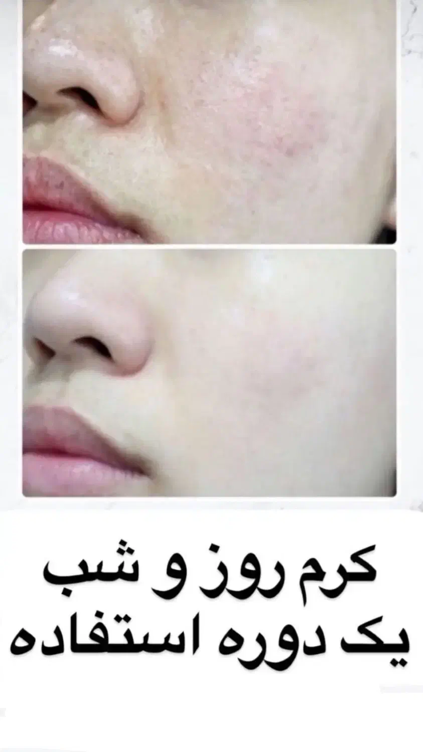 کرم روز و شب لاکچری کوین|آرایشی، بهداشتی، درمانی|شیراز, فرهنگ شهر|دیوار
