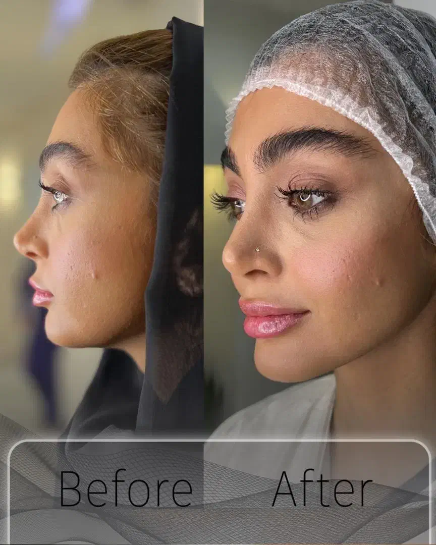 جوانسازی و لیفت بدون جراحی|خدمات آرایشگری و زیبایی|تهران, اختیاریه|دیوار