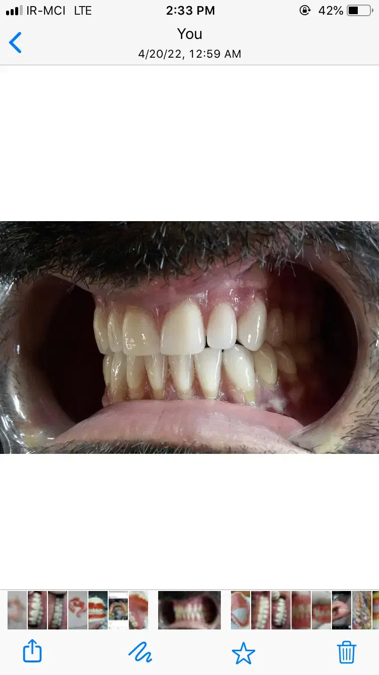 ساخت انواع دندان مصنوعی|خدمات آرایشگری و زیبایی|تهران, وحیدیه|دیوار