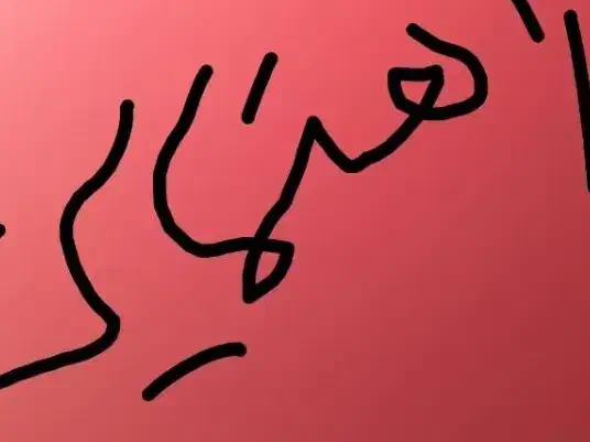 راهنمایی برای درمان آرترز کمر میخوام|فعالیت داوطلبانه تحقیقاتی|اردبیل, |دیوار