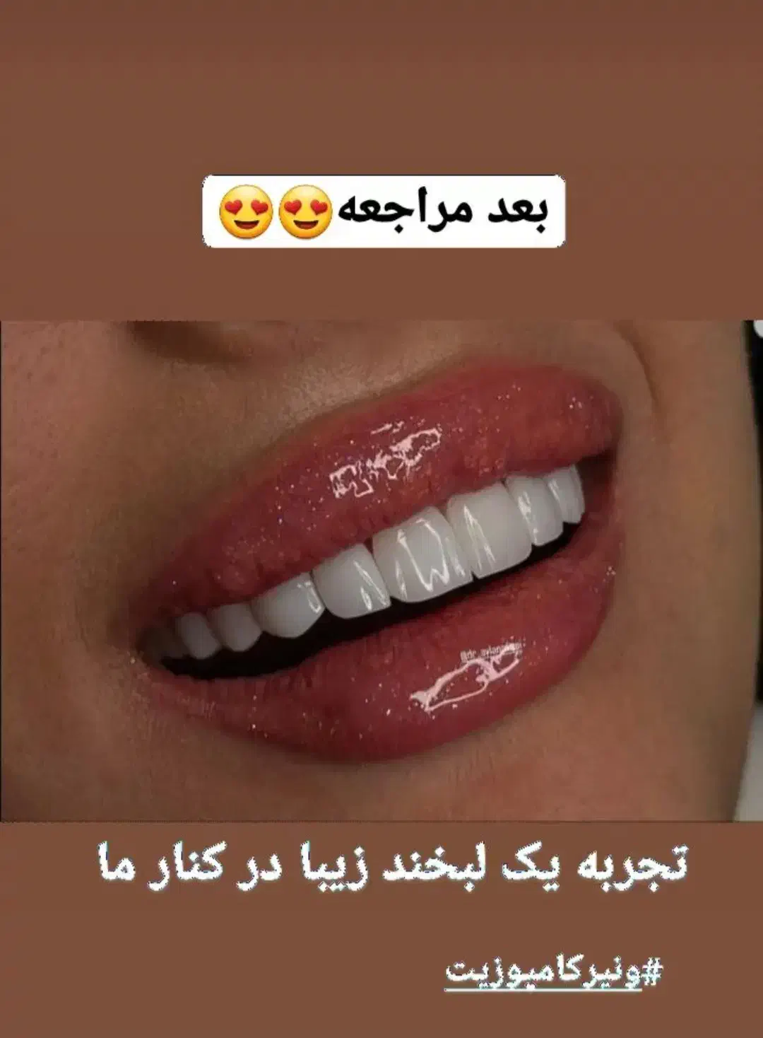درمان دندان با شرایط دلخواه + ویزیت رایگان|خدمات آرایشگری و زیبایی|مشهد, منزل آباد|دیوار