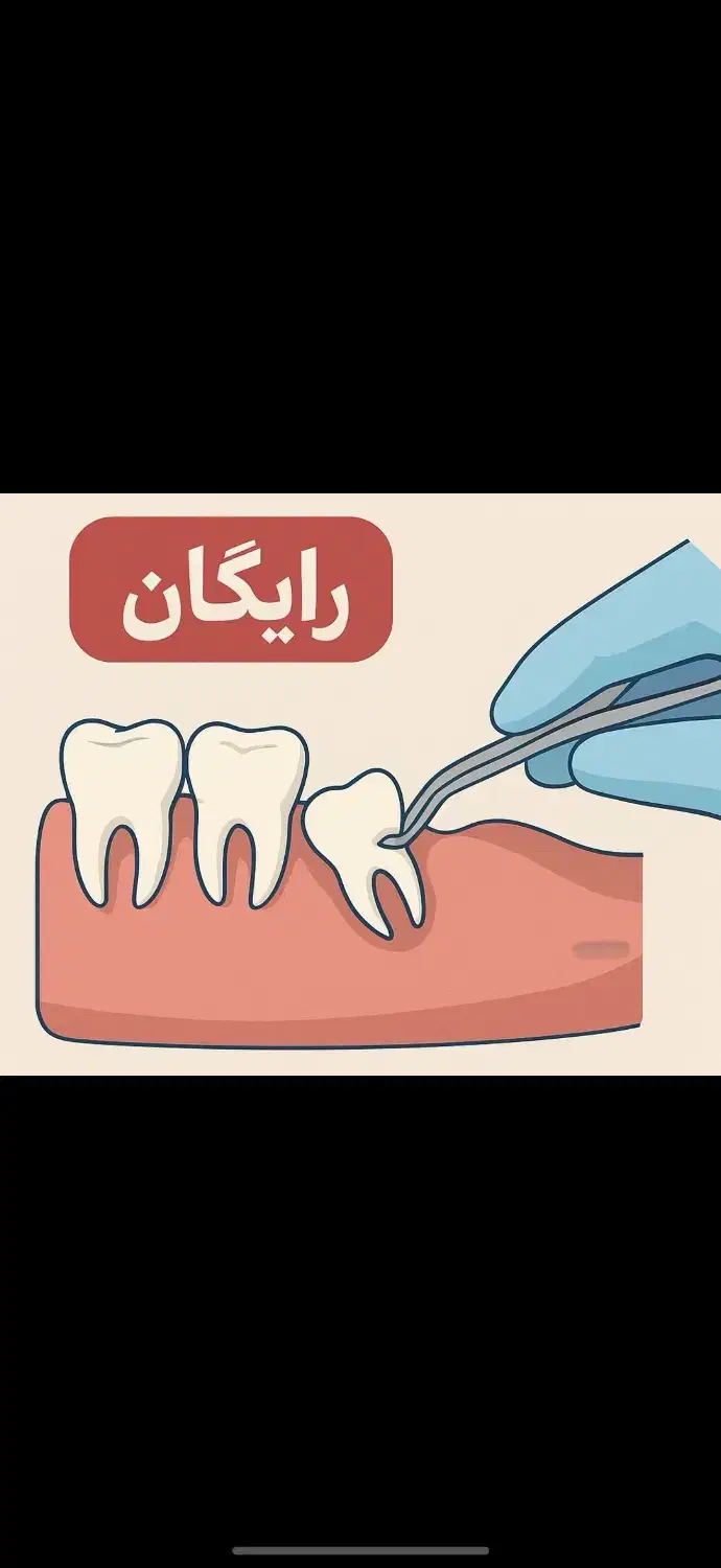 کشیدن دندان عقل|خدمات آرایشگری و زیبایی|زاهدان, |دیوار