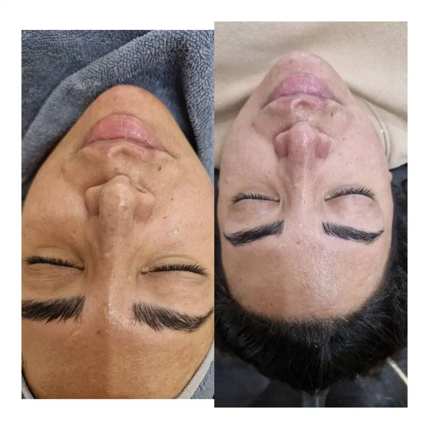 فشیال تخصصی و درمانی|خدمات آرایشگری و زیبایی|مشهد, ایثار|دیوار