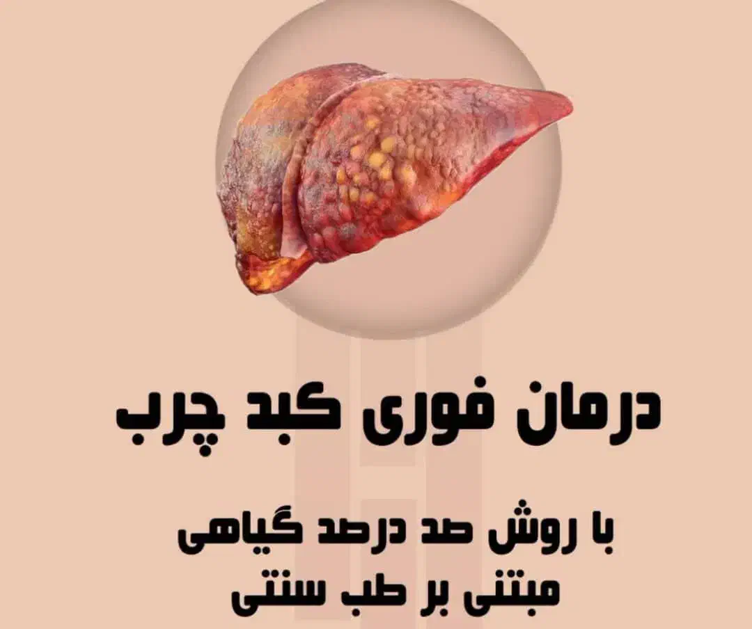 کبد اگه حرارتی بشه نه باازمایش نه سنوگرافی معلوم|فعالیت داوطلبانه|اهواز, اهواز|دیوار