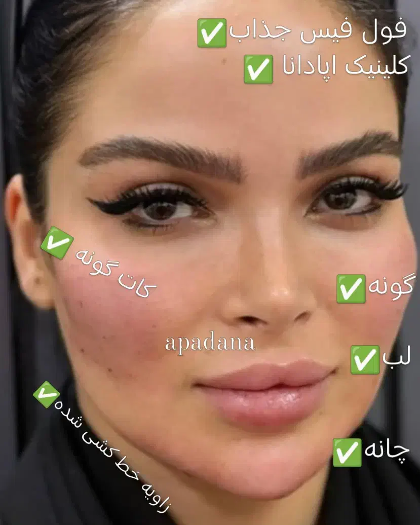 تزریق ژل ،فیلر بوتاکس مزو آنزیم خال برداری|خدمات آرایشگری و زیبایی|الیگودرز, |دیوار