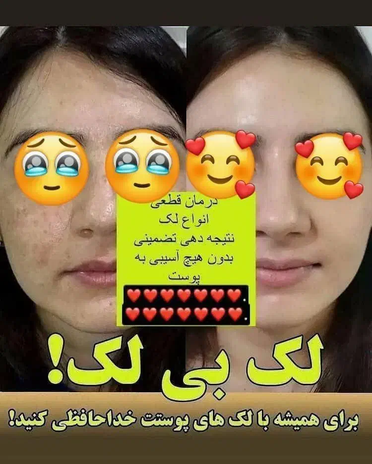 لاغری فقط فقط با عسل|خوردنی و آشامیدنی|دلگان, |دیوار