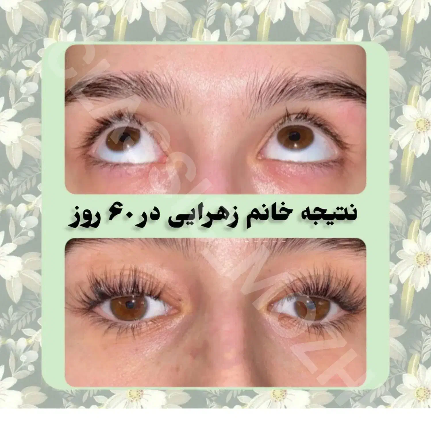 مژه ها و ابروهات رو تقویت و زیبا کن|خدمات آرایشگری و زیبایی|شیراز, ارم|دیوار