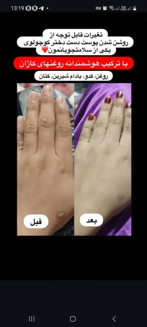 پوستت روزیباترکن|خدمات آرایشگری و زیبایی|مهران (هرمزگان), |دیوار