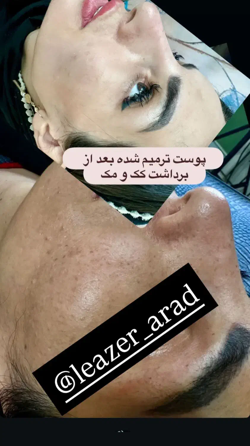 ریمولک تک جلسه ایی|خدمات آرایشگری و زیبایی|سرپل ذهاب, |دیوار