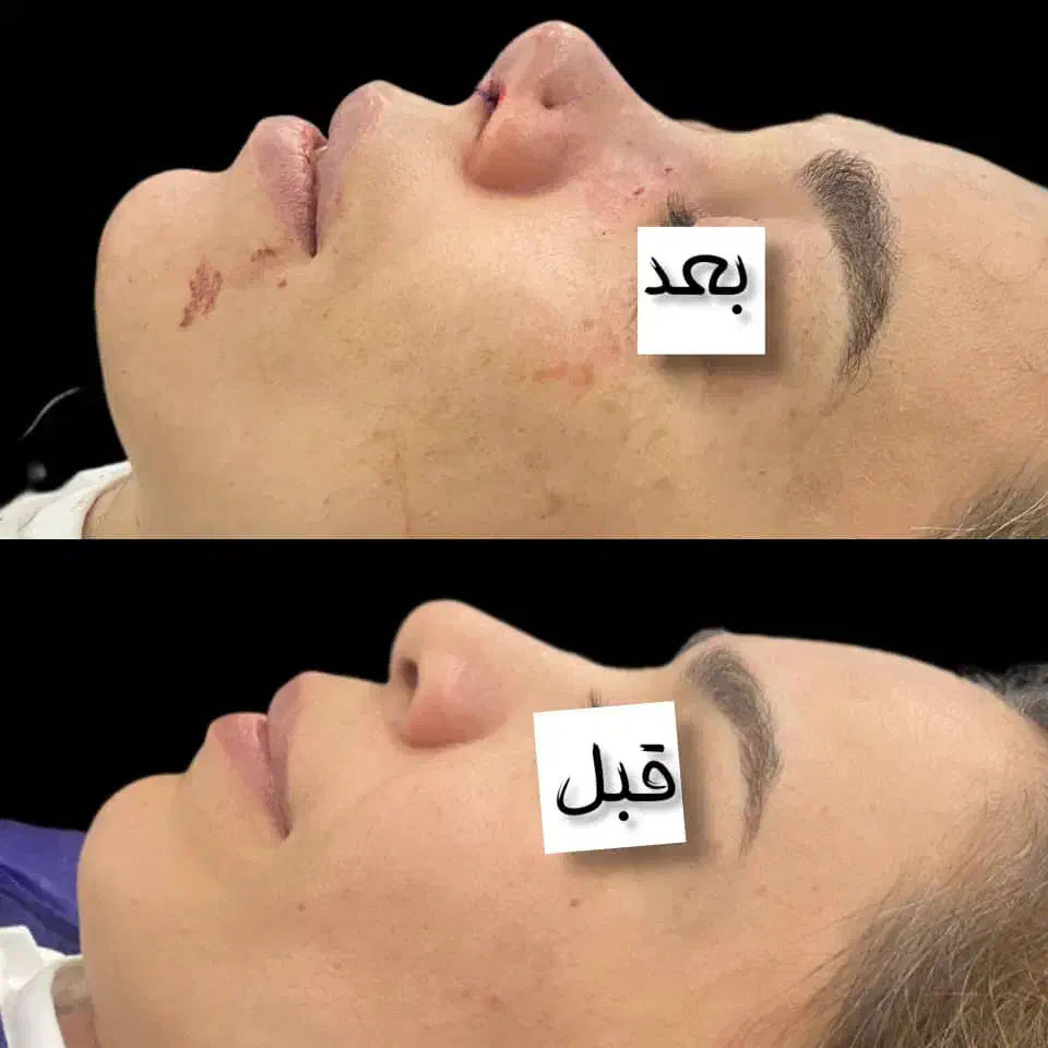 اف ویژه جراحی بینی در اهواز|خدمات آرایشگری و زیبایی|سوسنگرد, |دیوار