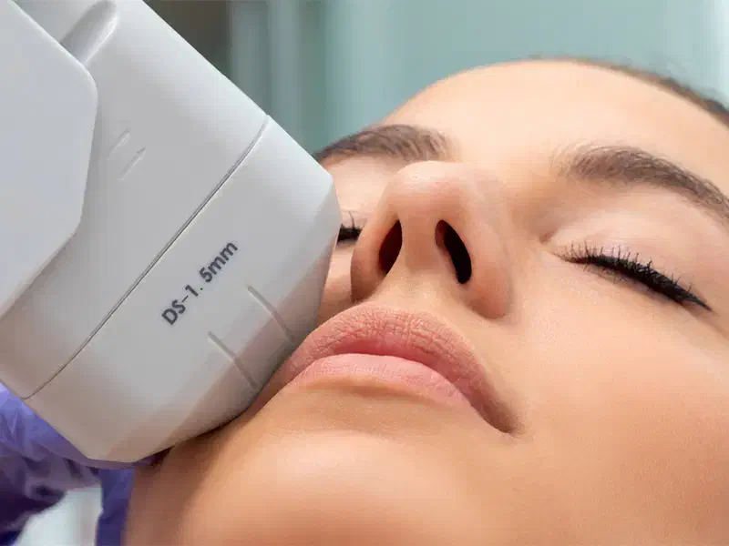 نیازمند دستگاه هایفو و کیوسوییچ جهت مطب زیبایی|استخدام درمانی، زیبایی، بهداشتی|یاسوج, |دیوار