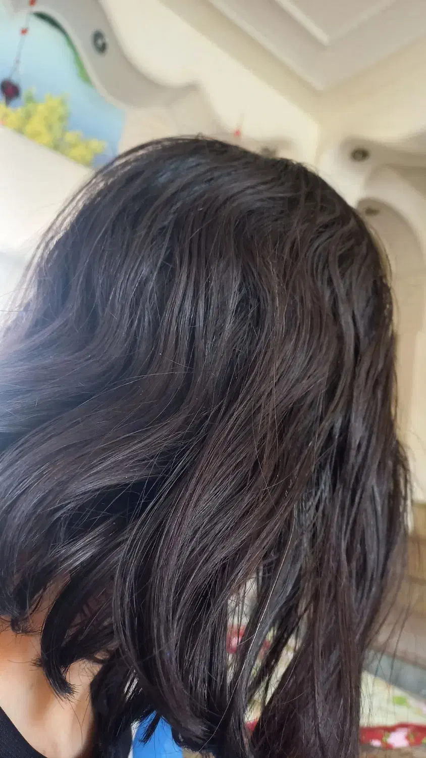 ریزش مو|فعالیت داوطلبانه تحقیقاتی|شیراز, پودنک|دیوار