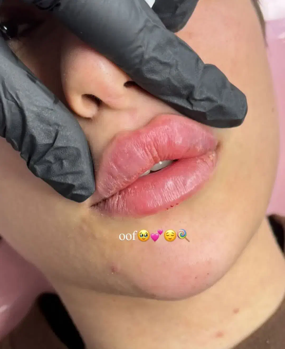 خدمات ژل و بوتاکس با بهترین مواد|خدمات آرایشگری و زیبایی|فسا, |دیوار