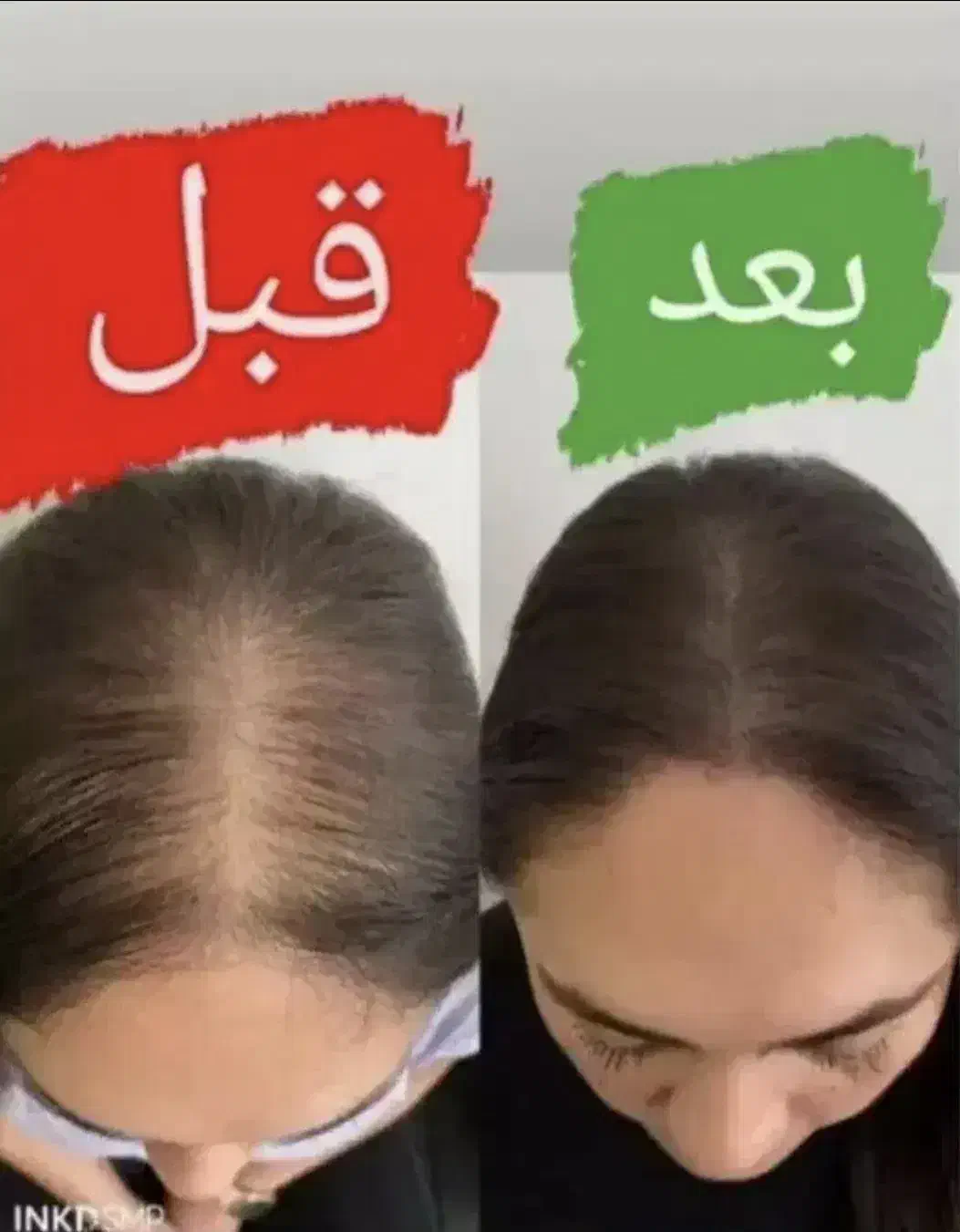 نماینده رسمی پخش تونیک هیرفرند|آرایشی، بهداشتی، درمانی|تهران, جردن|دیوار