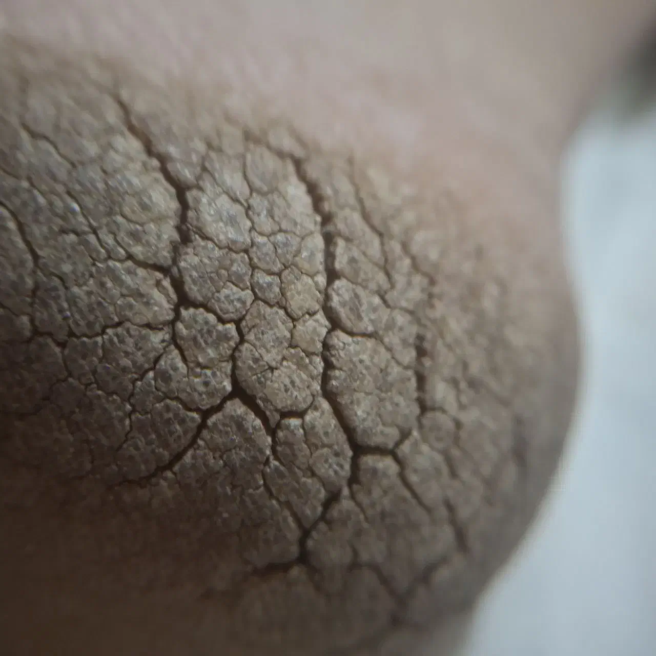 پدیکور درمانی آقایان در کلینیک پوست دریک‌جلسه|خدمات آرایشگری و زیبایی|پردیس, فاز ۲|دیوار