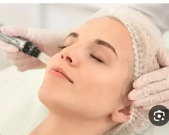 میکرونیدلینگ معجزه جوانسازی|خدمات آرایشگری و زیبایی|صدرا-فارس, فاز ۲|دیوار