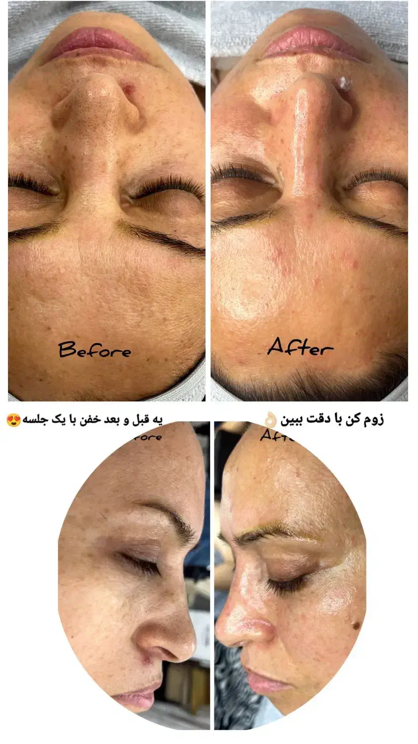 فیشال تخصصی + آموزش فیشال از صفر تا صد|خدمات آرایشگری و زیبایی|شیراز, طلاب|دیوار