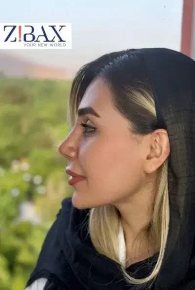 جراحی بینی در شیراز/نوبتگیری+وام+مشاور|خدمات آرایشگری و زیبایی|فیروزآباد (فارس), |دیوار