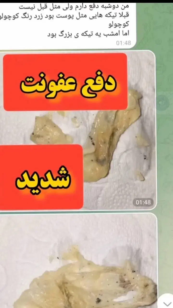 بهبودوپاکسازی رحم،کیست وفیبروم،تنبلی تخمدان،عفونت|خدمات آرایشگری و زیبایی|کلاله, |دیوار