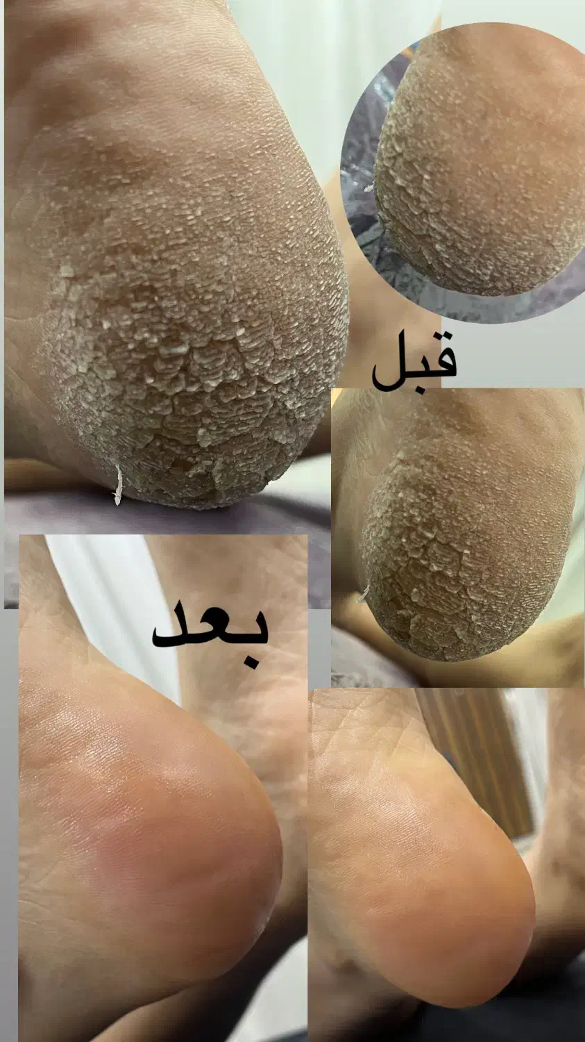 پدیکور پا (اموزش پدیکور) خدمات ناخن ، پاکسازی ، ا|خدمات آرایشگری و زیبایی|بوشهر, |دیوار