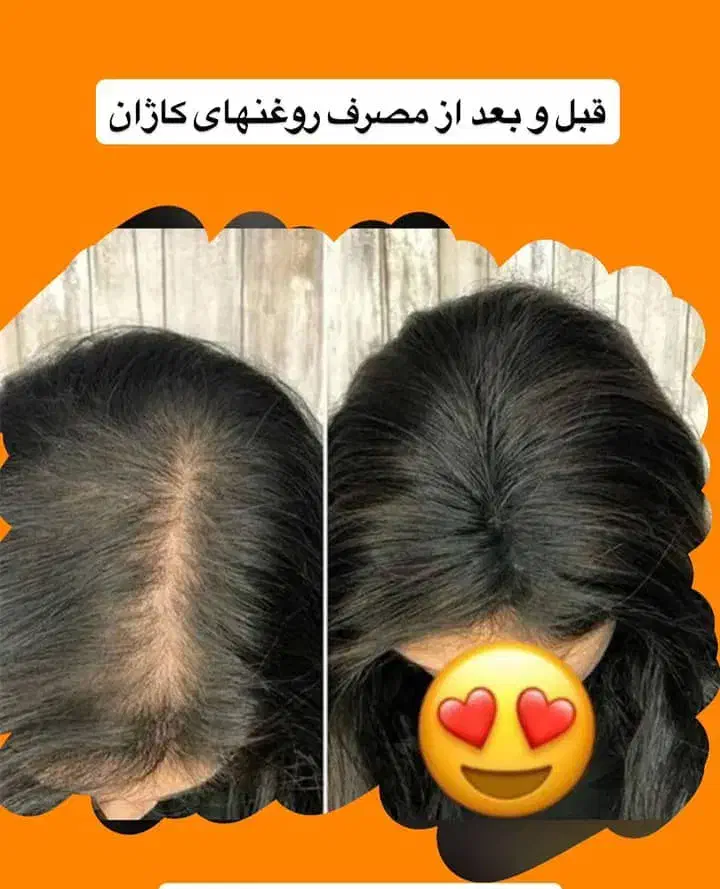 روغن تراپی|آرایشی، بهداشتی، درمانی|اهواز, عامری|دیوار