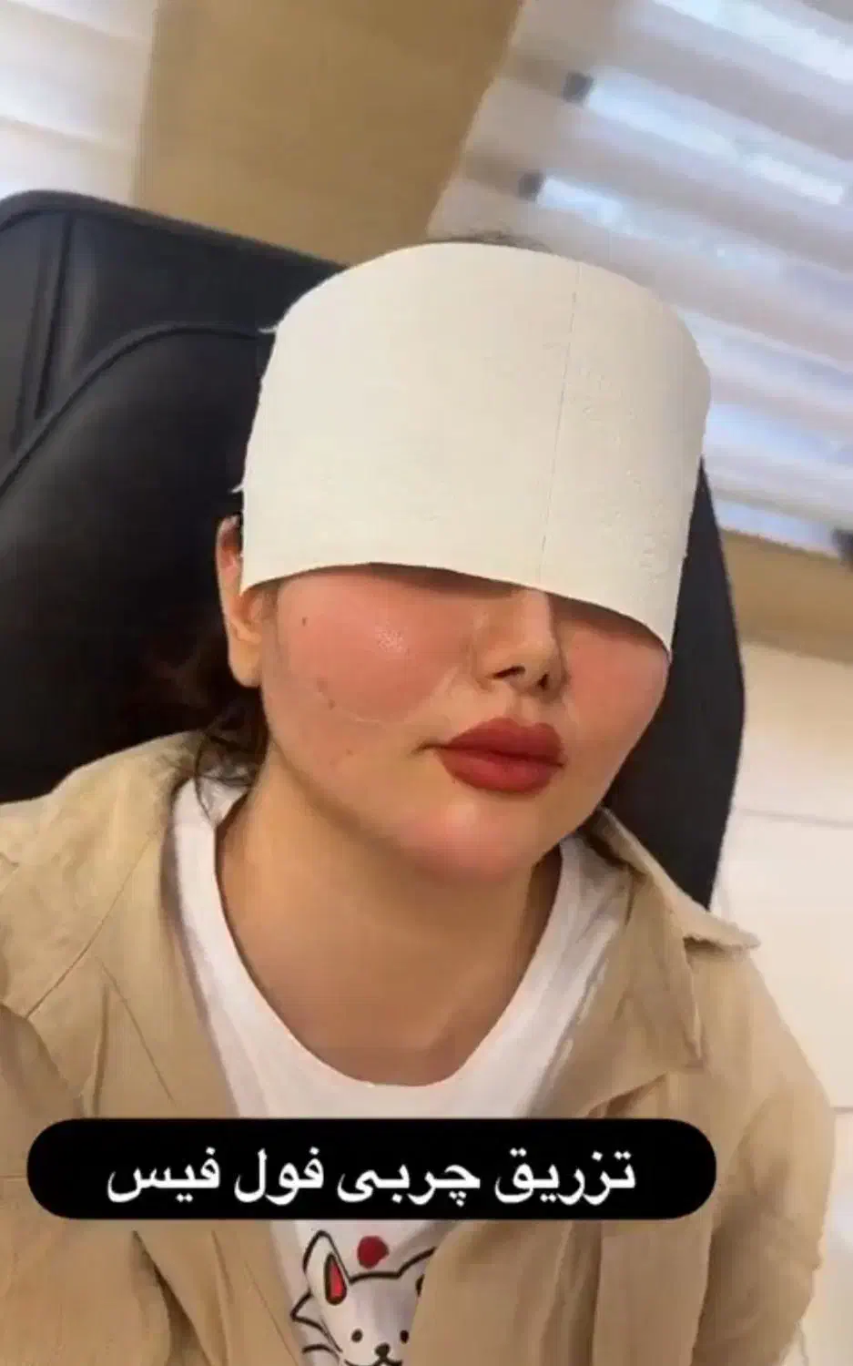 لیپوساکشن|خدمات آرایشگری و زیبایی|بروجرد, |دیوار