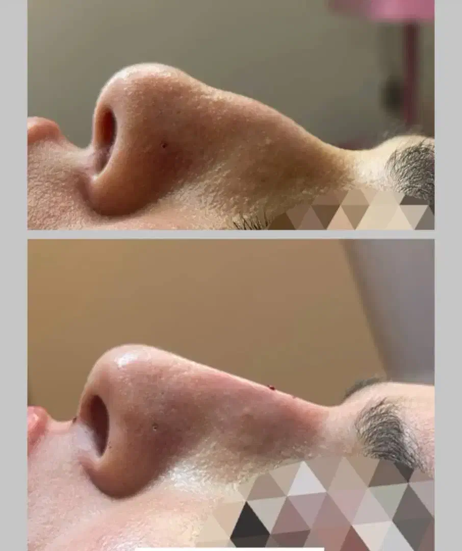 مطب پزشک.ژل وبوتاکس.لیفت بانخ.فیلربینی ژل آلت|خدمات آرایشگری و زیبایی|قم, دورشهر|دیوار