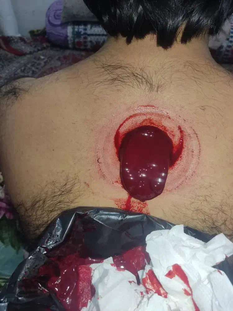 حجامت|خدمات آرایشگری و زیبایی|زاهدان, |دیوار