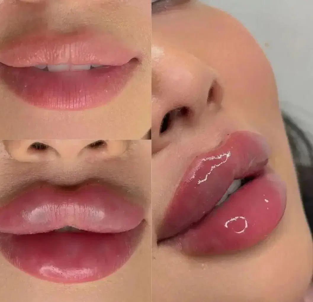 جشنواره ژل بوتاکس فیلر لیزرجوانسازمزو|خدمات آرایشگری و زیبایی|تبریز, |دیوار