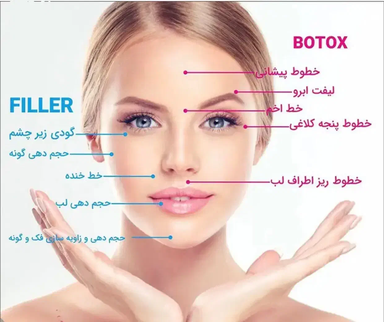 مدل تزریق فیلر(ژل) و بوتاکس|خدمات آرایشگری و زیبایی|ساری, |دیوار