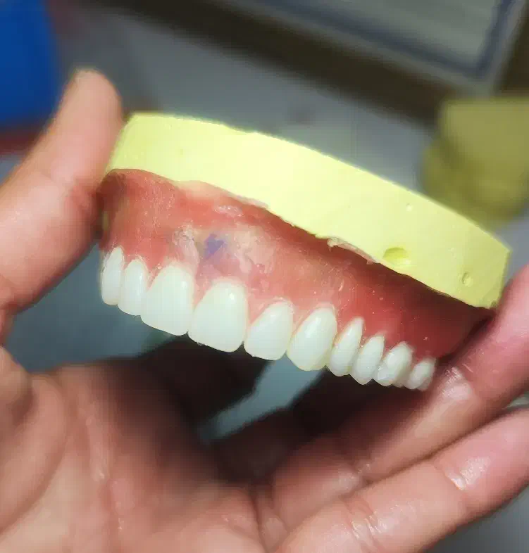 دندانسازی دندان مصنوعی|خدمات آرایشگری و زیبایی|نیشابور, امام خمینی|دیوار