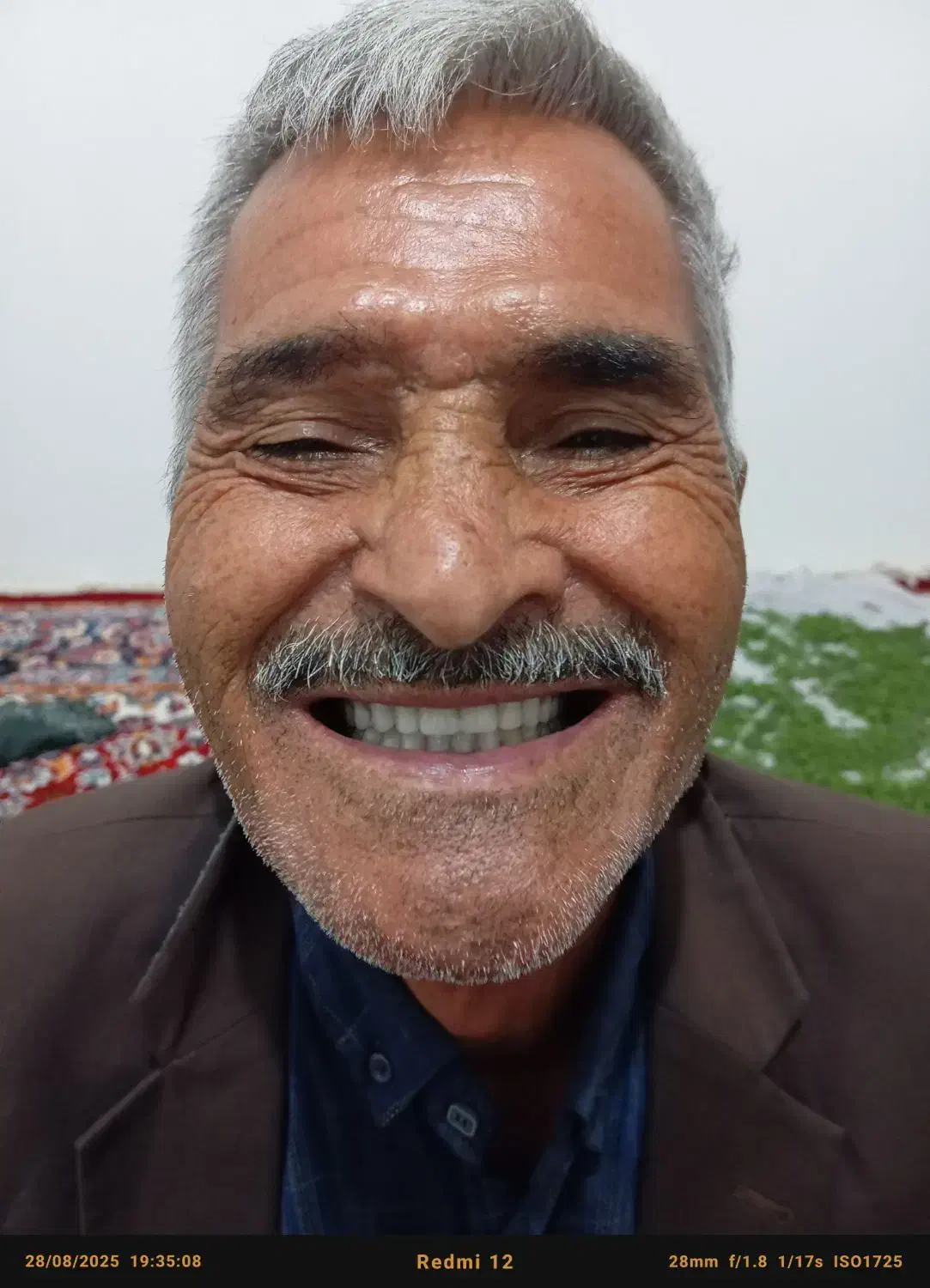 دندانسازی|آرایشی، بهداشتی، درمانی|جغتای, |دیوار