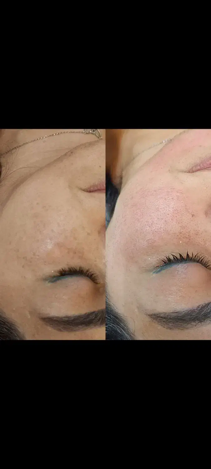 پزشکی آف ویژه|خدمات آرایشگری و زیبایی|بروجرد, |دیوار