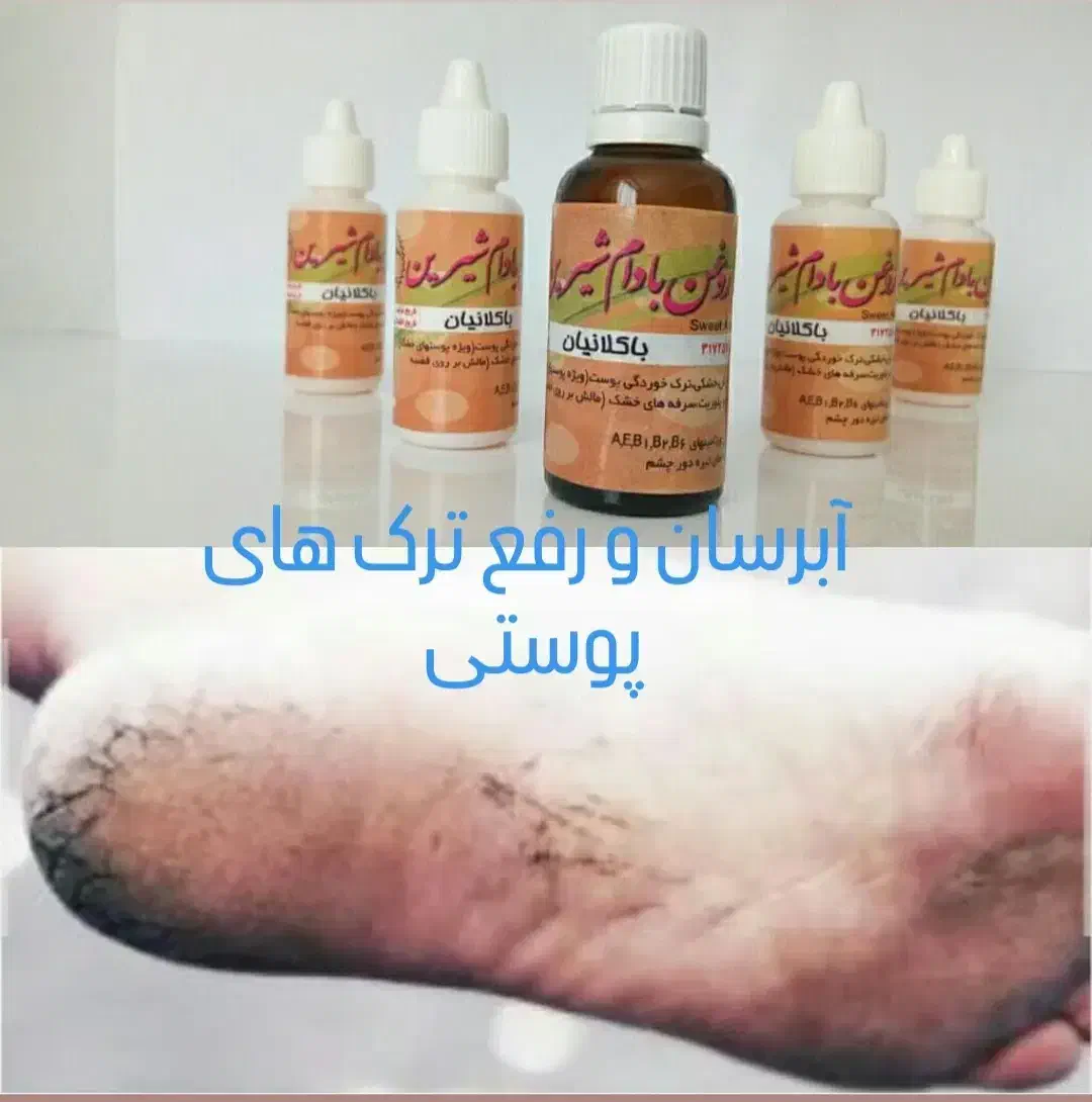 خراطین|آرایشی، بهداشتی، درمانی|محمدشهر, محمدشهر|دیوار