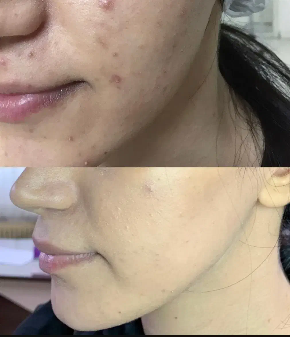 آموزش فشیال پاکسازی پوست غیرحضوری تضمینی|خدمات آموزشی|کرمانشاه, |دیوار