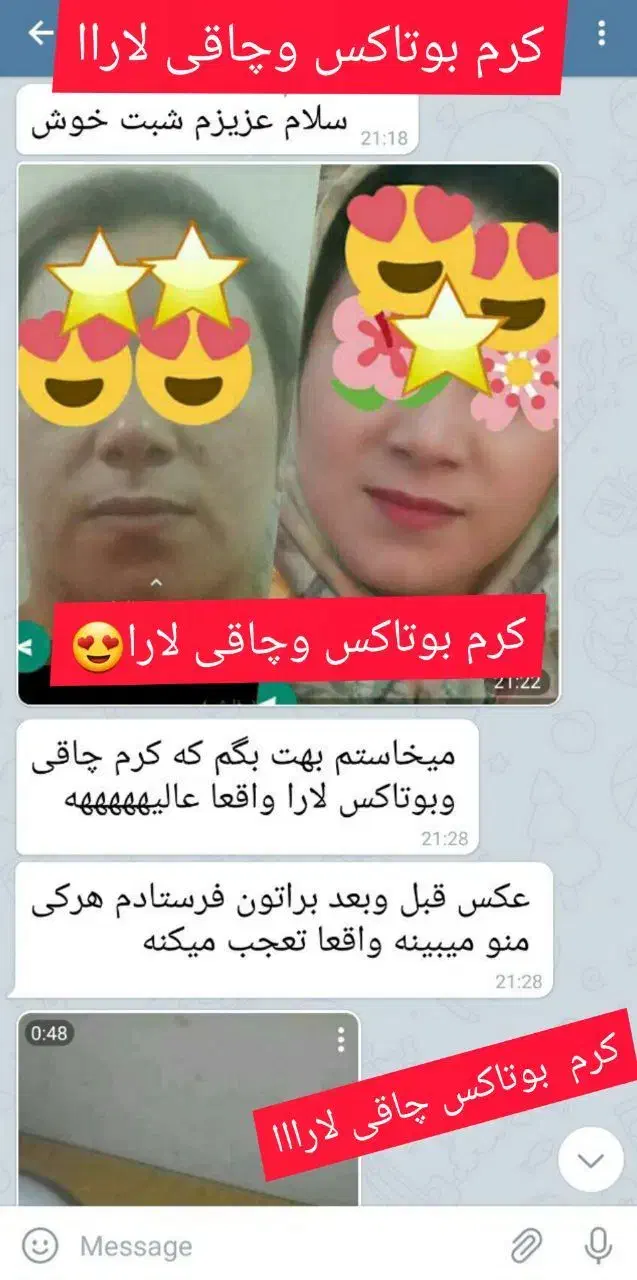 کرم بوتاکس و چاقی صورت لارا|آرایشی، بهداشتی، درمانی|مرودشت, ثبت احوال|دیوار