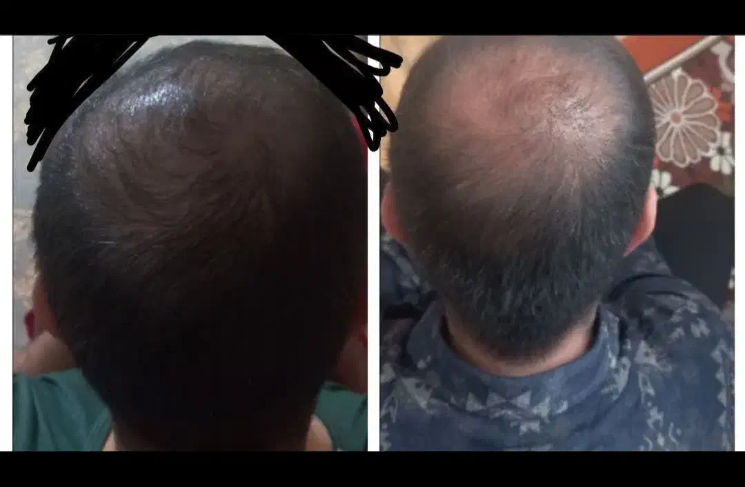 معجزه پک|حراج|قم, باجک دو|دیوار