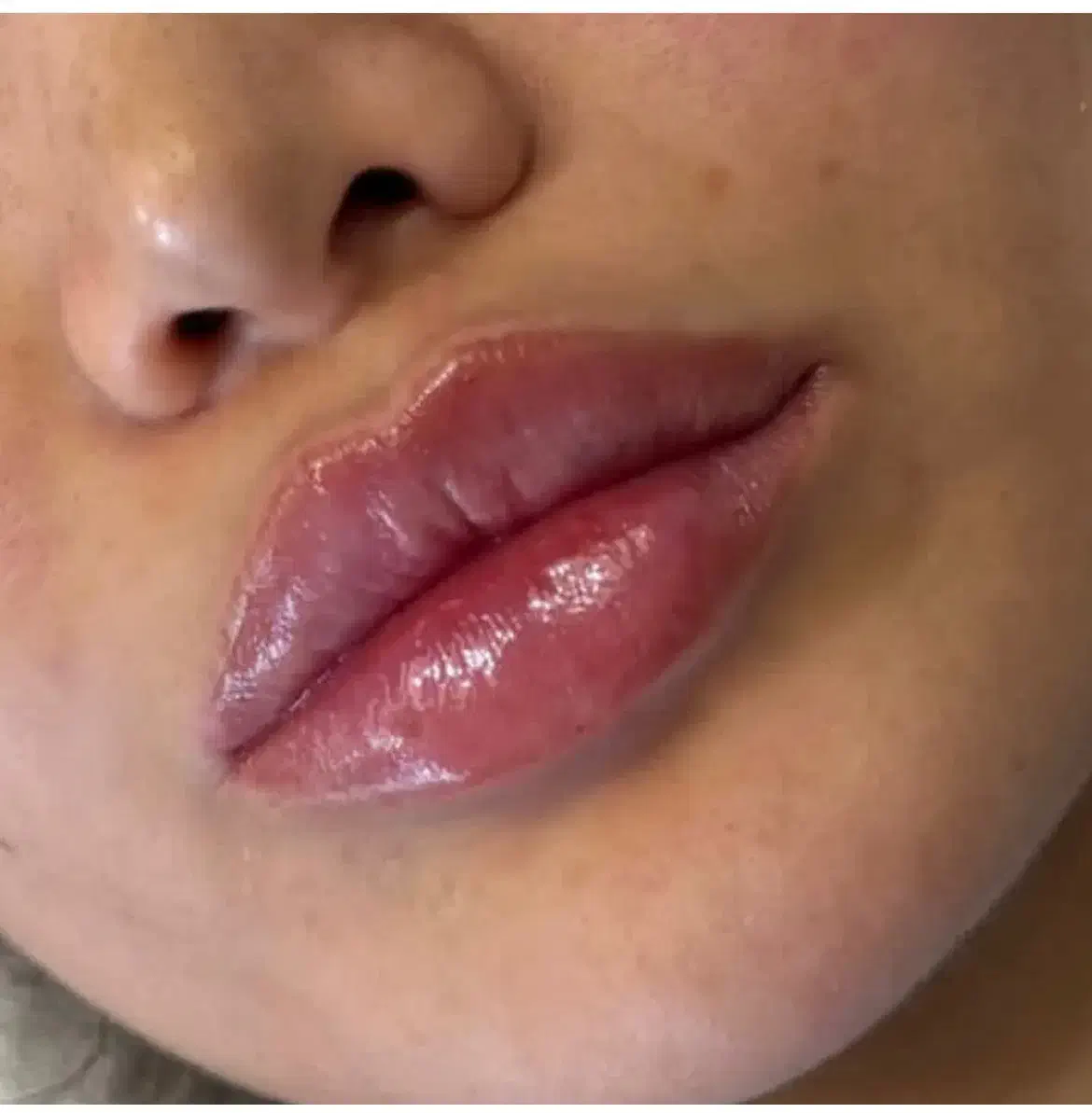 جشنواره تخفیف ژل لبروسی،فیلرشقیقه،بوتاکس توسط پزشک|خدمات آرایشگری و زیبایی|کرج, گلشهر|دیوار