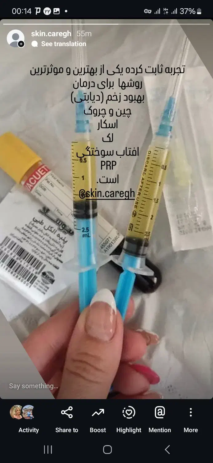 پی آرپی و مزوتراپی و سلول بنیادی|خدمات آرایشگری و زیبایی|خوی, |دیوار