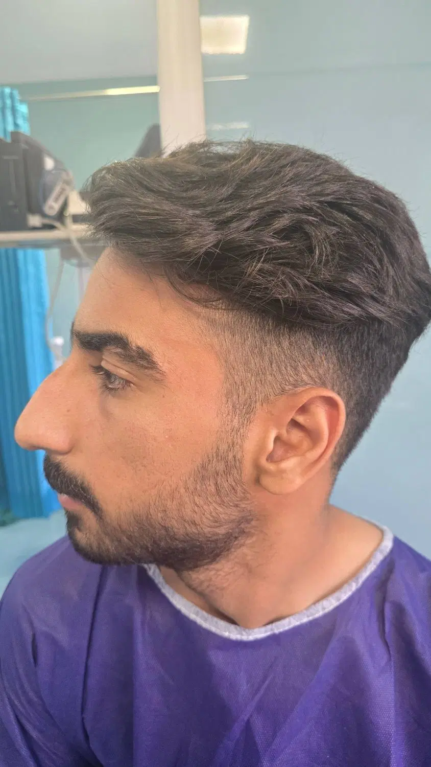 جراحی بینی متخصص جراح فک صورت ۴۵میلیون|خدمات زیبایی و سلامت|تهران, صاحبقرانیه|دیوار